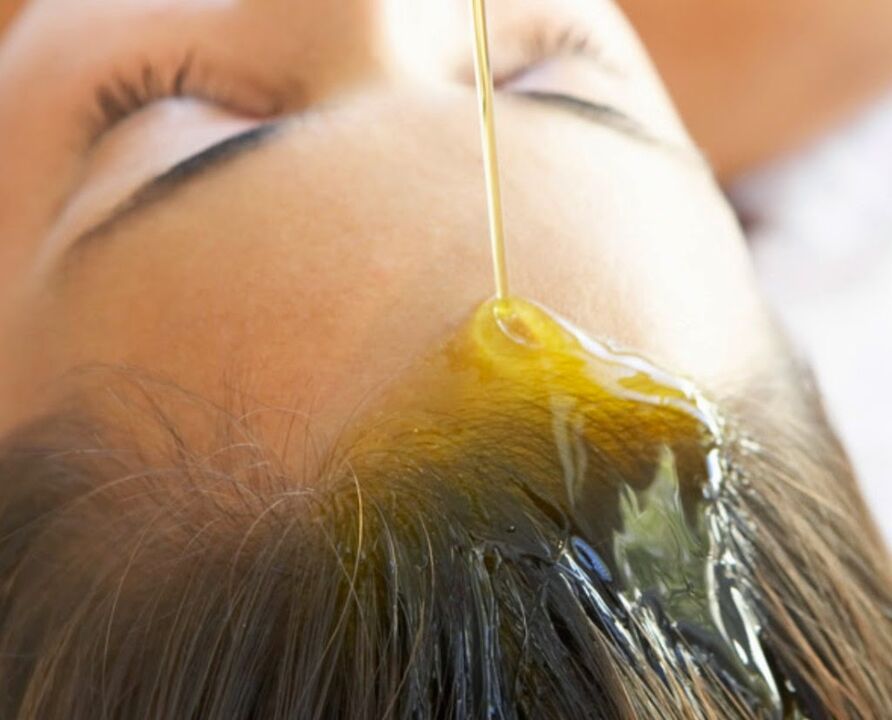 oil for scalp psoriasis