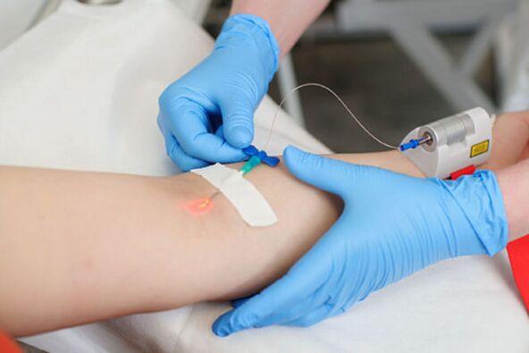 Intravenous laser treatment for foot psoriasis