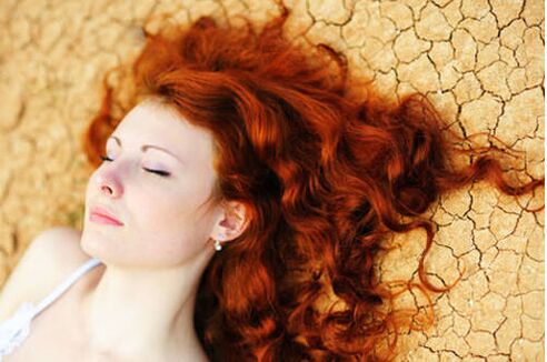 The girl with psoriasis