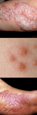 Red spots on the body